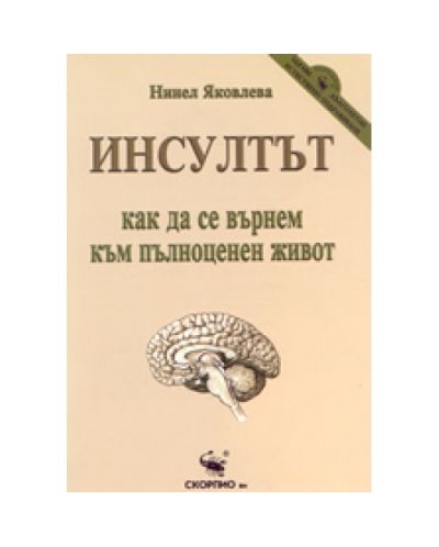 Инсултът