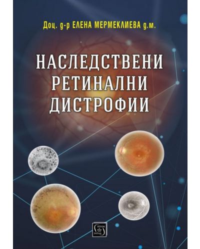 Наследствени ретинални дистрофии