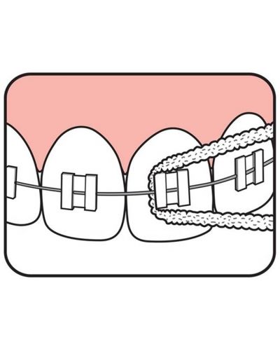 Tepe Конец за зъби Bridge & Implant, 30 броя - 3