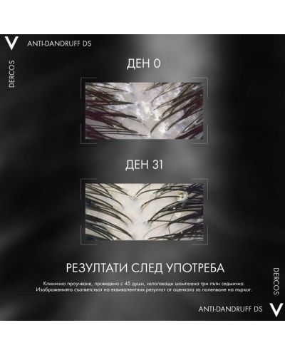 Vichy Dercos Комплект - Шампоан против пърхот за мазна коса Anti-dandruff DS + Пълнител, 200 + 500 ml - 5