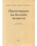 Протезиране на беззъби челюсти - 1t