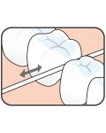 Tepe Овосъчен конец за зъби, 40 m - 3t